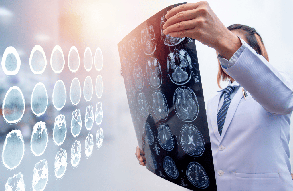 Photo of a doctor looking at patient scans after brain injury