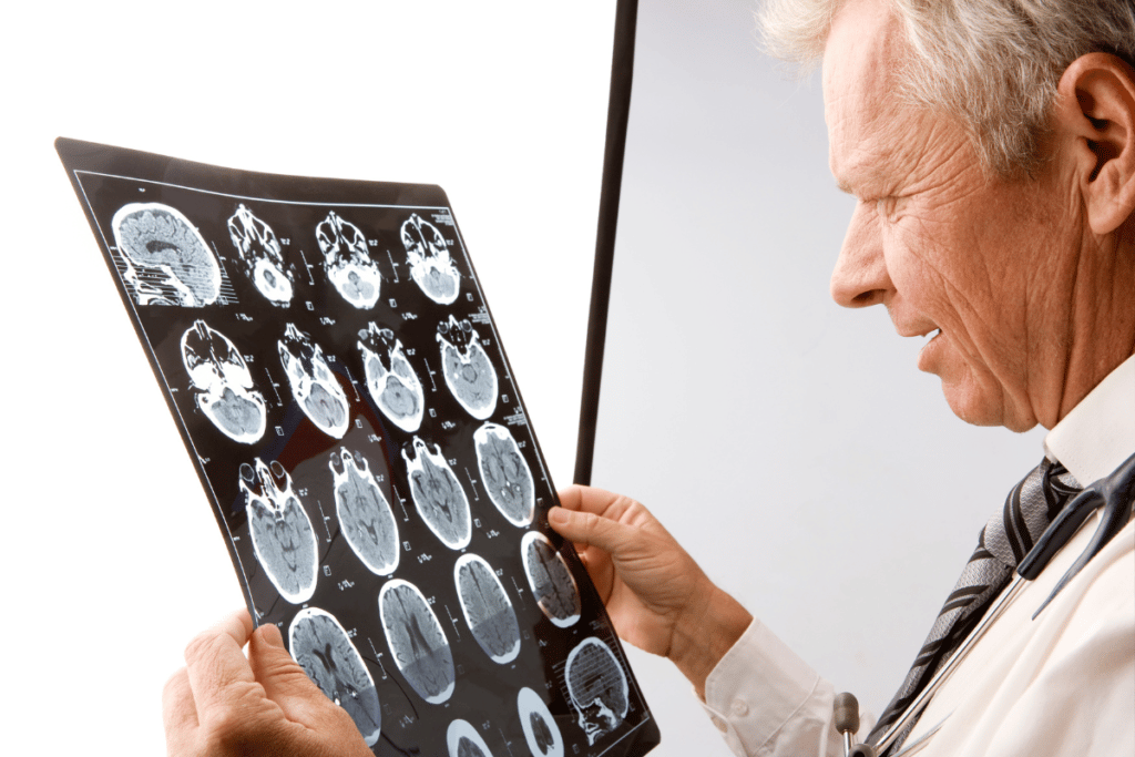 Doctor reviewing brain imaging