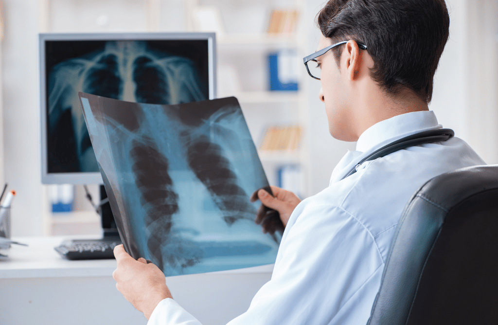 Doctor for asbestos lung cancer